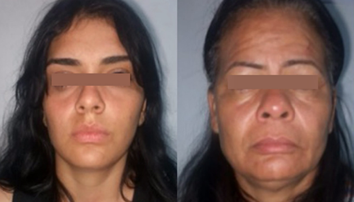 Detenidas dos mujeres por ataque con bisturí en Villa de Cura